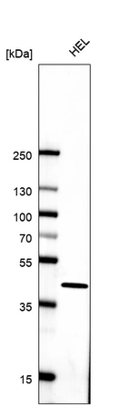 Western blot analysis in human cell line HEL.