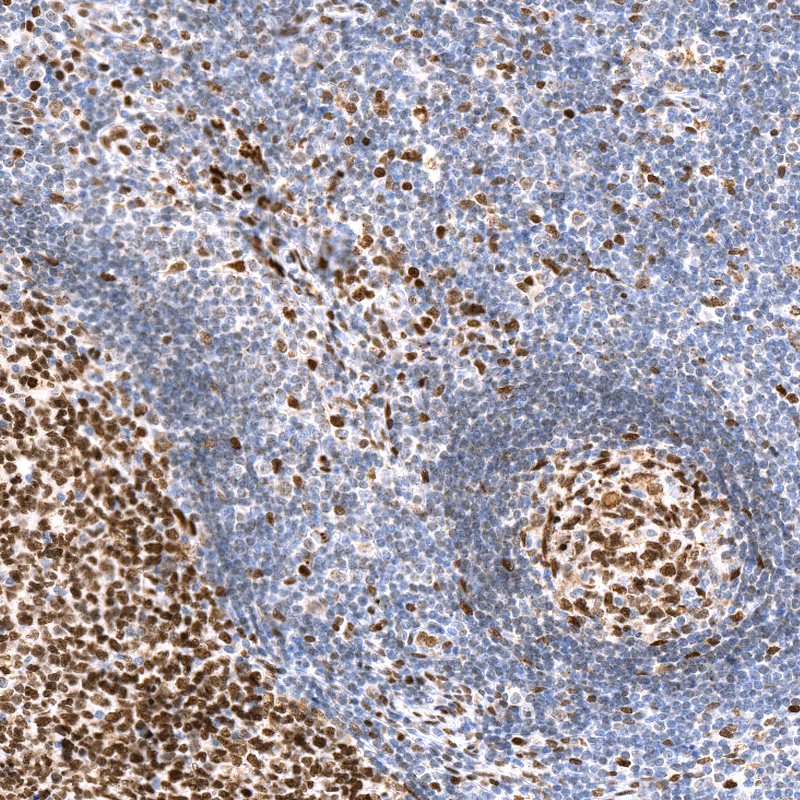 Anti-CUX1 Recombinant Antibody