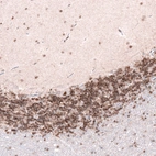 Immunohistochemical staining of human cerebellum shows moderate nuclear positivity in neuronal cells in granular, molecular and Purkinje cell layers.