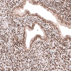 Immunohistochemical staining of human endometrium shows moderate to strong nuclear positivity in glandular and stromal cells.