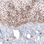 Immunohistochemical staining of human uterine cervix shows strong nuclear positivity in epithelial cells.