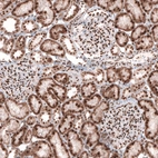 Immunohistochemical staining of human kidney shows strong nuclear positivity in cells in glomeruli.