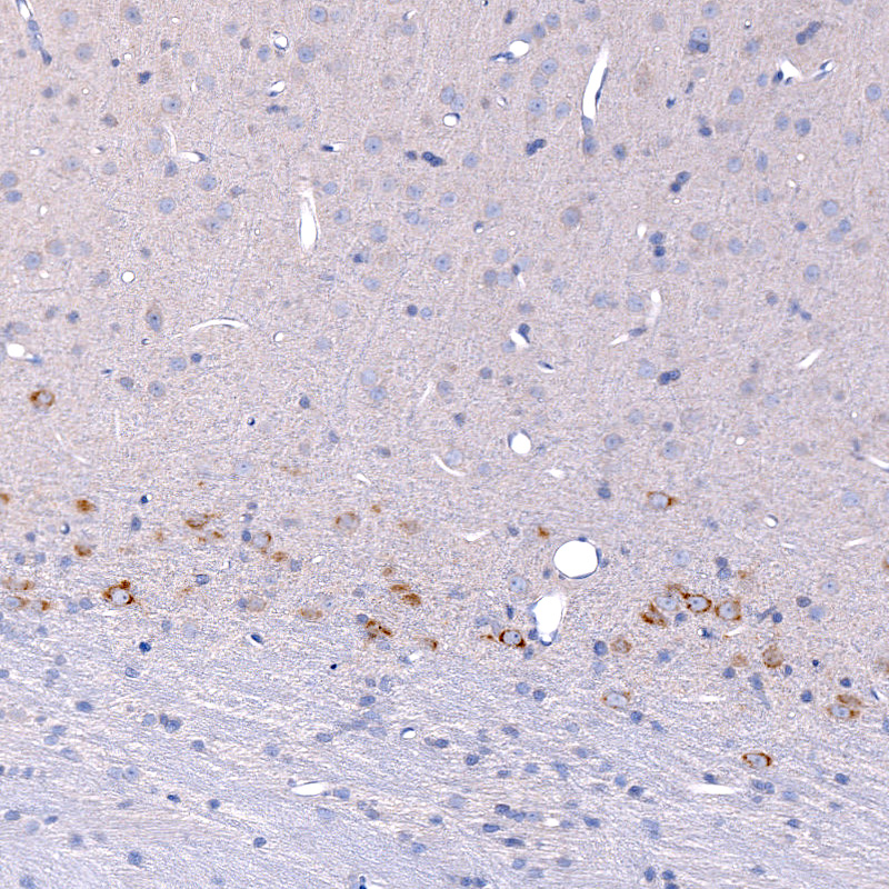 Anti-CTGF Recombinant Antibody