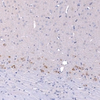 Anti-CTGF Recombinant Antibody