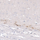 Immunohistochemical staining of mouse cerebral cortex shows moderate cytoplasmic positivity in the layer 6b neurons.