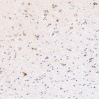 Immunohistochemical staining of human cerebral cortex shows moderate cytoplasmic positivity in the neurons of layer 6b.