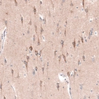 Immunohistochemical staining of human cerebral cortex shows strong cytoplasmic positivity in layer 6b neurons.
