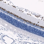 Anti-PAX6 Recombinant Antibody