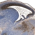 Immunohistochemical staining of mouse embryo E11 shows strong nuclear positivity in the developing cerebral cortex.