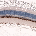 Immunohistochemical staining of rat eye retina shows strong nuclear positivity in the inner nuclear layer and ganglion cell layer.