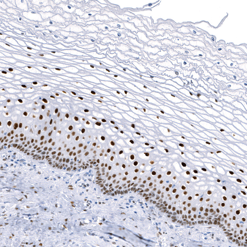 Anti-KLF4 Recombinant Antibody