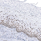 Anti-KLF4 Recombinant Antibody