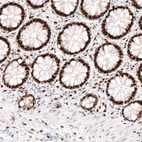 Immunohistochemical staining of human rectum shows strong nuclear immunoreactivity in glandular cells.