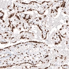 Immunohistochemical staining of human placenta shows nuclear positivity in the trophoblast.