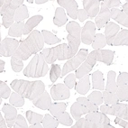 Immunohistochemical staining of human skeletal muscle shows absence of positivity in striated muscle fibers as expected (negative control).