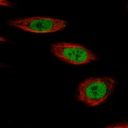 Immunofluorescence staining of PC-3 cells using the Anti-KLF4 monoclonal antibody, showing specific staining in the nucleoplasm in green. Microtubule- and nuclear probes are visualized in red and blue, respectively (where available).