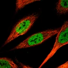 Immunofluorescence staining of PC-3 cells using the Anti-KLF4 monoclonal antibody, showing specific staining in the nucleoplasm in green. Microtubule- and nuclear probes are visualized in red and blue, respectively (where available).