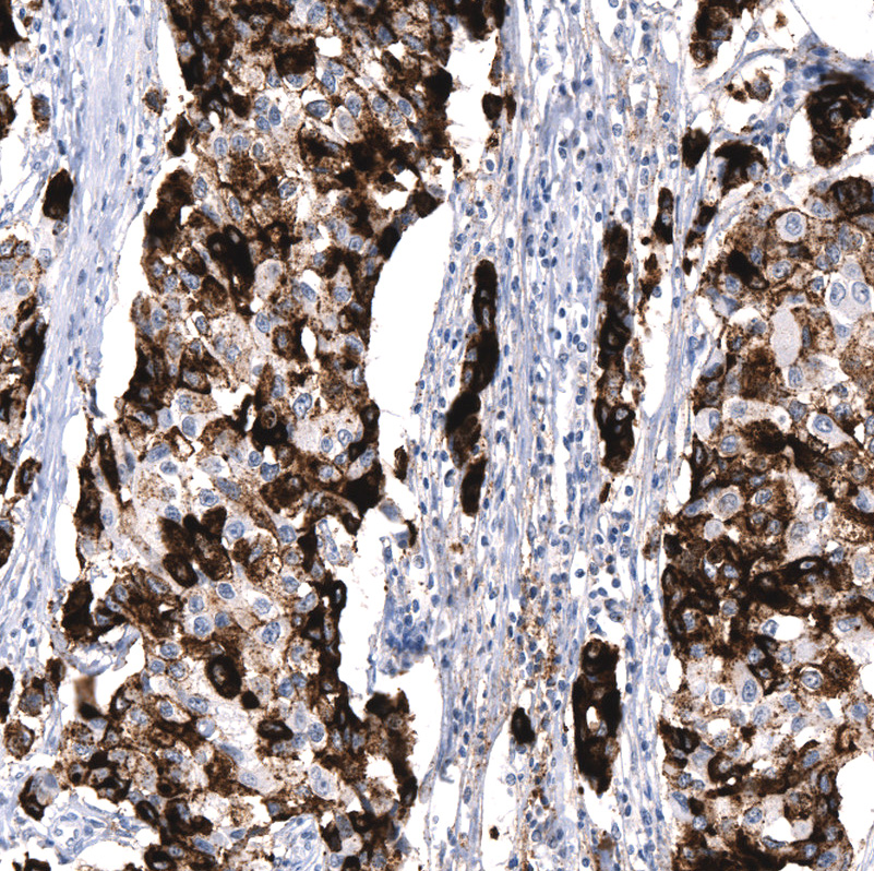 Anti-MUC5AC Recombinant Antibody