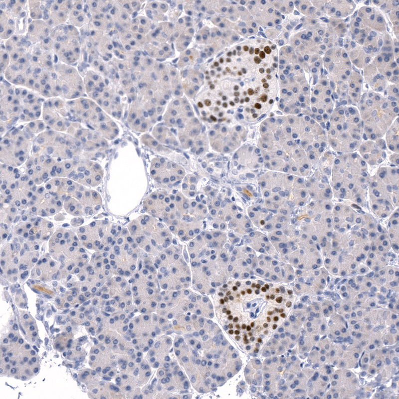 Anti-INSM1 Recombinant Antibody