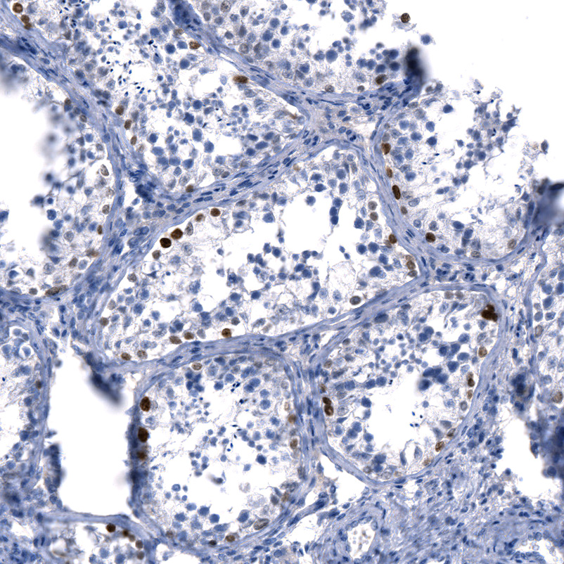 Anti-SALL4 Recombinant Antibody