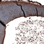 Immunohistochemical staining of mouse embryo E11 shows moderate to strong nuclear positivity in a subset of cells in the developing hindbrain.