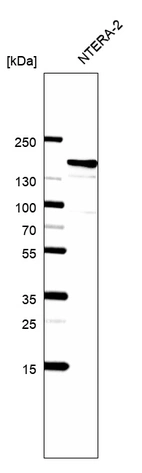 Western blot analysis in human cell line NTERA-2.