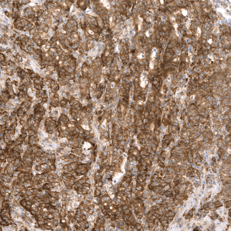 Anti-GSPT1 Recombinant Antibody