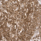 Anti-GSPT1 Recombinant Antibody