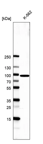Western blot analysis in human cell line K562.