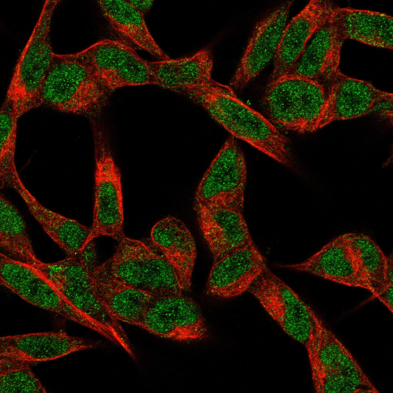 Anti-CUX2 Recombinant Antibody