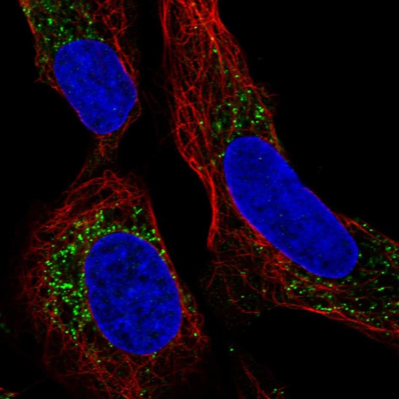 Anti-PMEPA1 Antibody