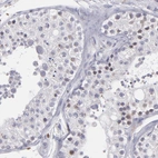 Immunohistochemical staining of human testis shows very weak positivity in cells in seminiferous ducts.