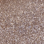 Immunohistochemical staining of human lymphoid tissues shows moderate nuclear positivity in non-germinal center cells.