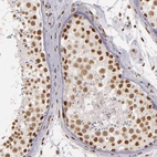 Immunohistochemical staining of human testis shows moderate nuclear positivity in cells in seminiferous ducts.