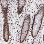 Immunohistochemical staining of human gastrointestinal shows moderate nuclear positivity in glandular cells and lymphoid cells