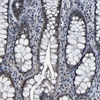 Immunohistochemical staining of human colon shows moderate nuclear positivity in glandular cells.