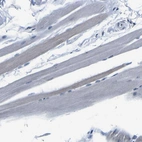 Immunohistochemical staining of human skeletal muscle shows no positivity in myocytes.