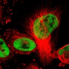 Immunofluorescent staining of human cell line U-251 MG shows localization to nucleoplasm.