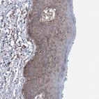 Immunohistochemical staining of human skin shows moderate cytoplasmic positivity in epidermal cells.