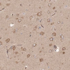Immunohistochemical staining of human cerebral cortex shows moderate cytoplasmic positivity in neuronal cells.