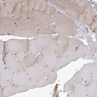 Immunohistochemical staining of human skeletal muscle shows weak cytoplasmic positivity in myocytes as expected.