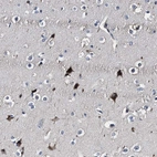 Immunohistochemical staining of human cerebral cortex shows moderate nuclear positivity in subset if neuronal cells with cytoplasmic positivity.