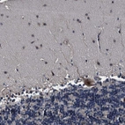 Immunohistochemical staining of human cerebellum shows moderate nuclear positivity subset molecular layer cells.