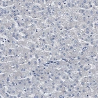 Immunohistochemical staining of human liver shows no positivity in hepatocytes.