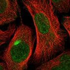 Immunofluorescent staining of human cell line U-2 OS shows localization to nuclear speckles & aggresome.