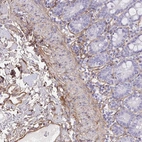 Immunohistochemical staining of human small intestine shows strong membranous positivity in peripheral nerve / ganglion.