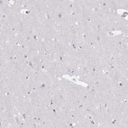 Immunohistochemical staining of human cerebral cortex shows no positivity in neuronal cells as expected.