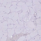 Immunohistochemical staining of human skeletal muscle shows no positivity in myocytes as expected.
