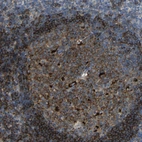 Immunohistochemical staining of human tonsil shows strong cytoplasmic positivity in germinal center cells and non-germinal center cells.