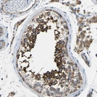 Immunohistochemical staining of human testis shows strong cytoplasmic positivity in cells in seminiferous ducts.